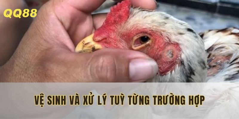 Cần rửa tay sạch trước khi tiếp xúc mắt
